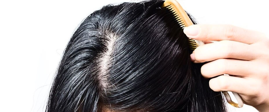hair and scalp health